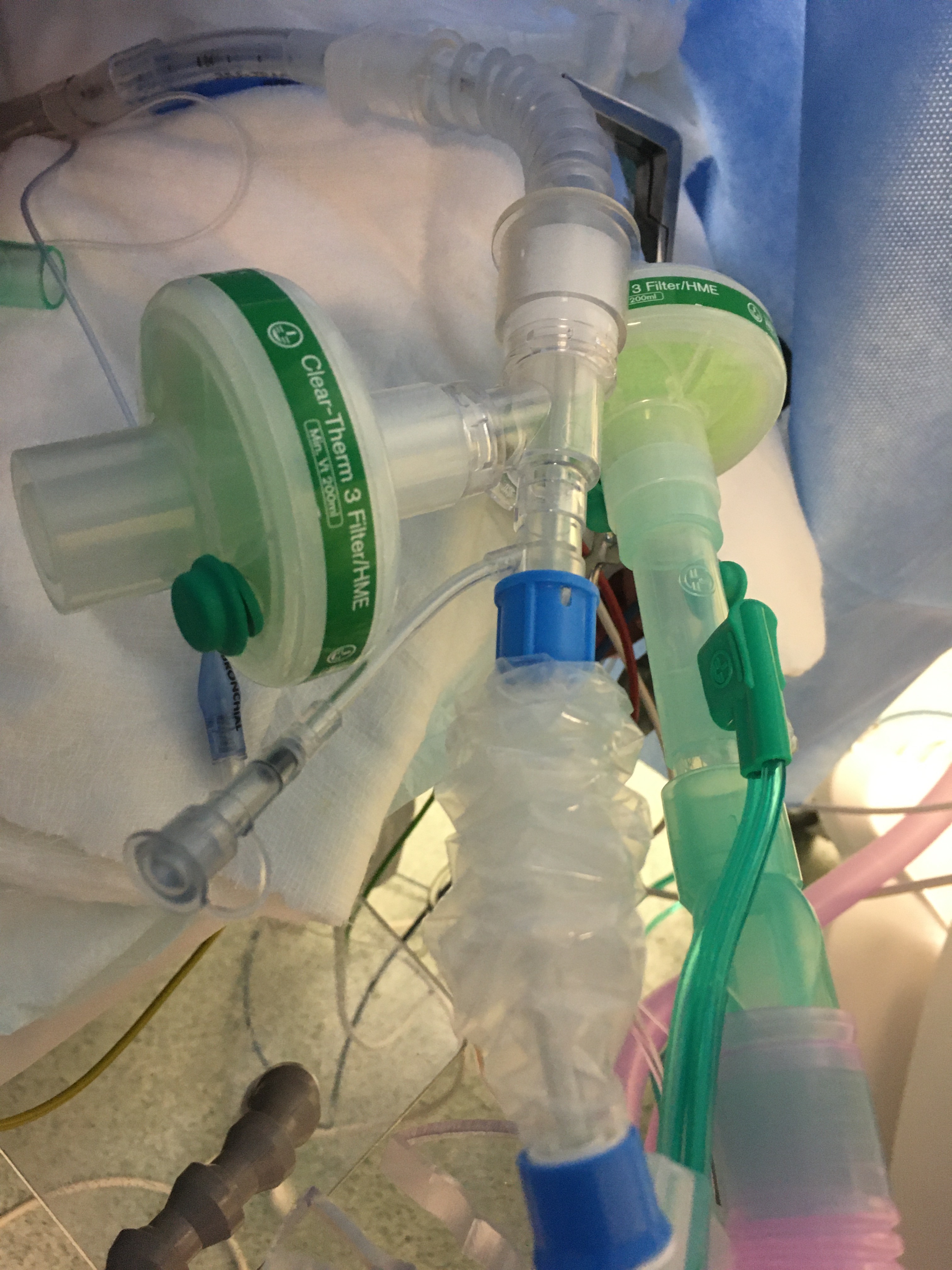 Letter_on_safe_lung_deflation_Figure 3